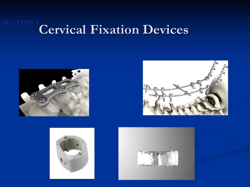 Cervical Fixation Devices SECTION I